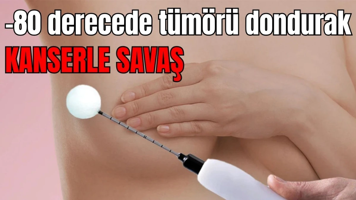 -80 derecede t&uuml;m&ouml;r&uuml; dondurarak kanserle savaş