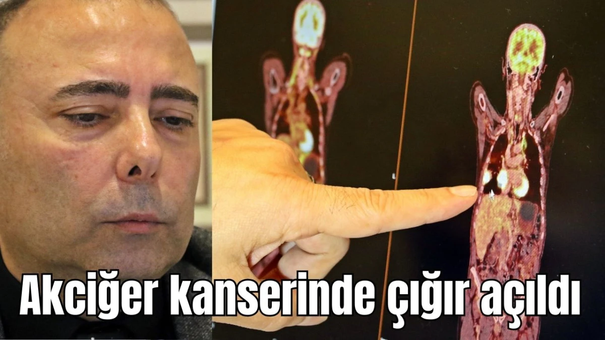 Akciğer kanserinde çığır açıldı