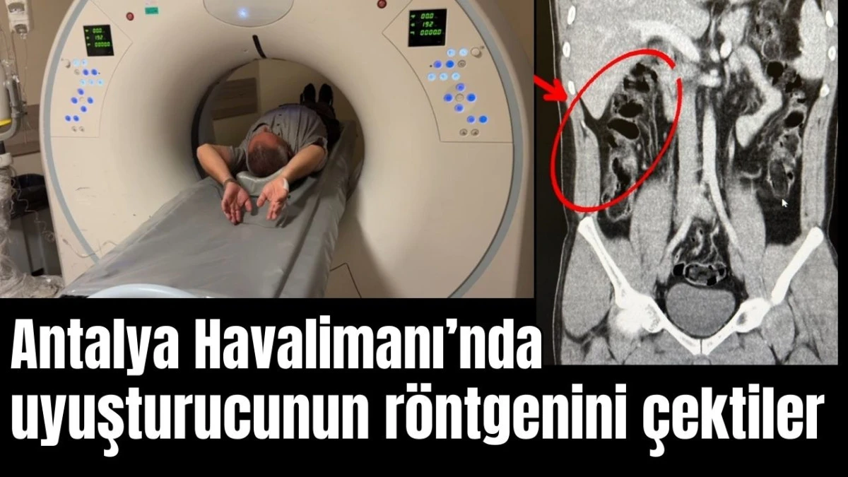 Antalya Havalimanı'nda uyuşturucunun röntgenini çektiler