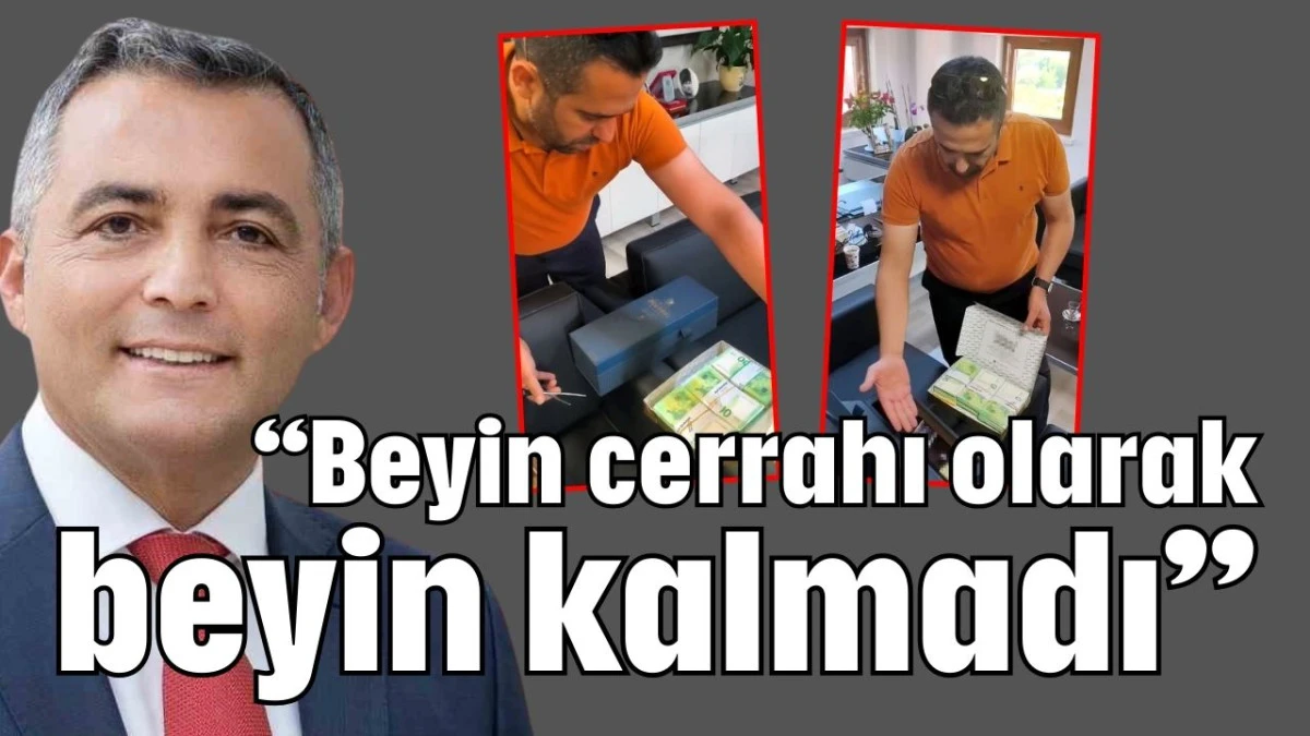 &ldquo;Beyin cerrahı olarak beyin kalmadı&rdquo; 