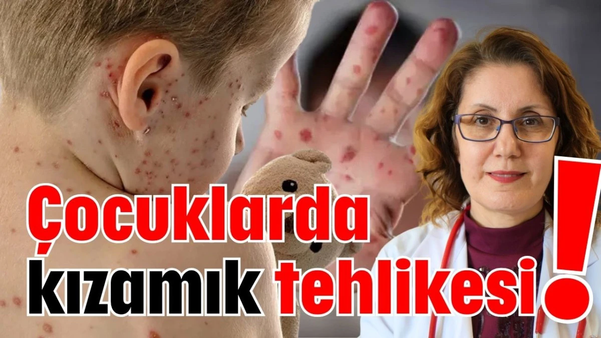 &Ccedil;ocuklarda kızamık tehlikesi!