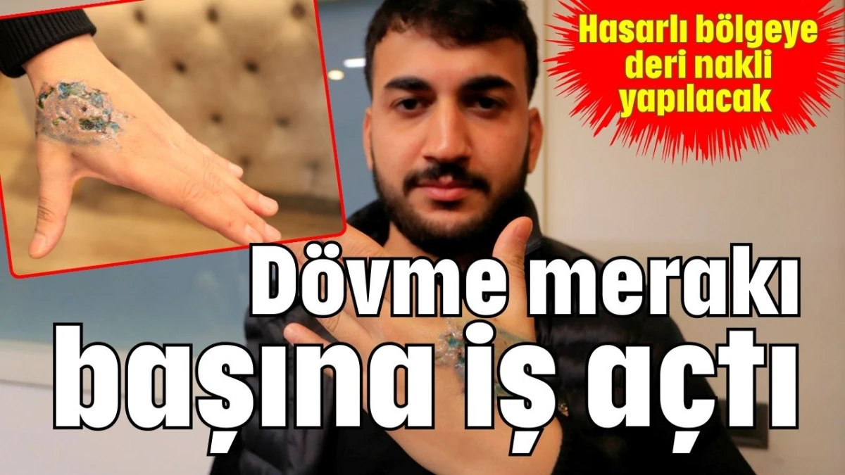 D&ouml;vme merakı başına iş a&ccedil;tı 