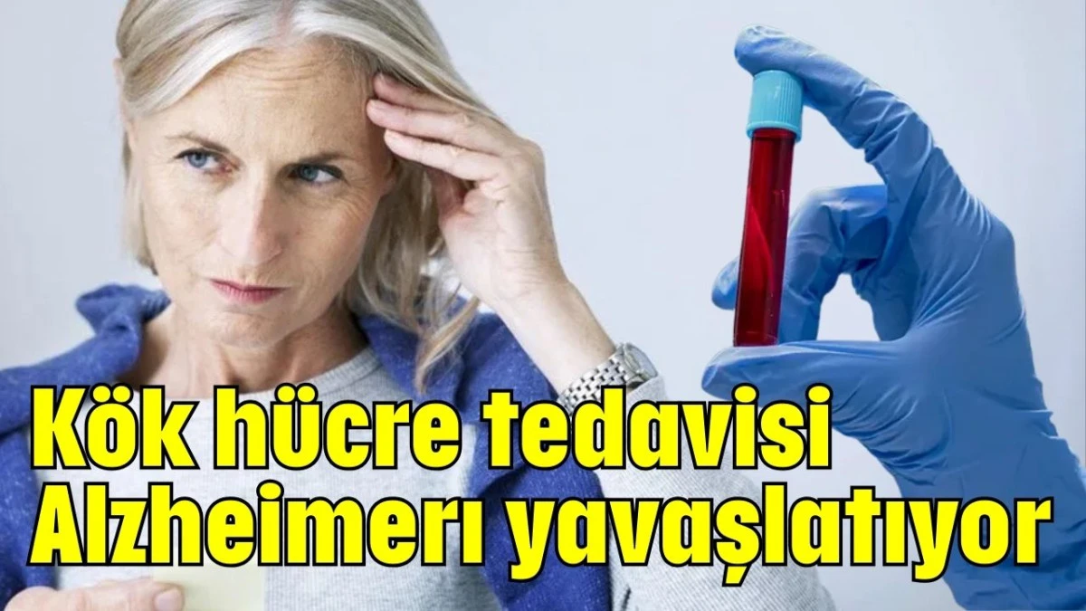Kök hücre tedavisi Alzheimerı yavaşlatıyor 
