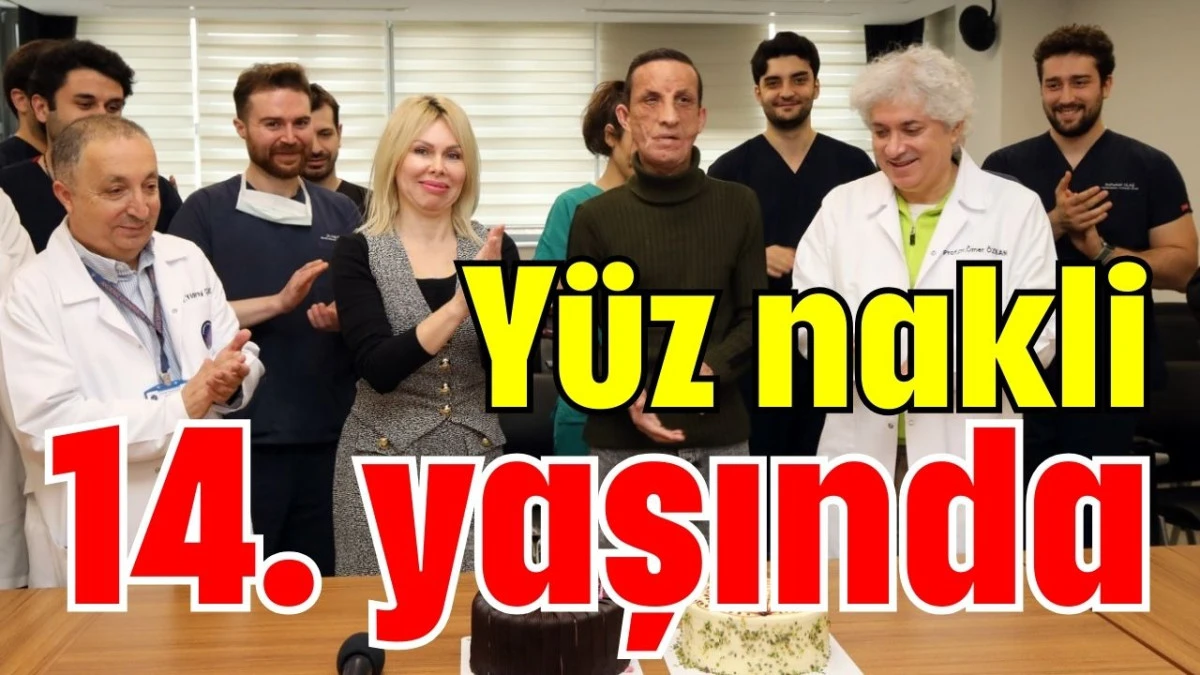 Y&uuml;z nakli 14. yaşında 